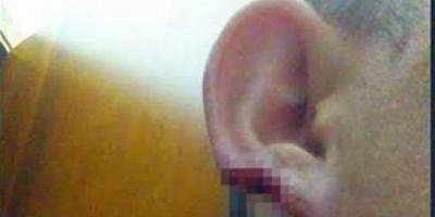 Homem arranca pedaço do nariz e orelha do namorado de sua ex