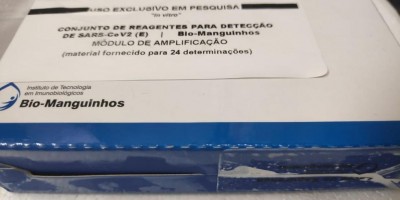 Pesquisadores de MG desenvolvem testes para acelerar diagnóstico de Covid-19;...