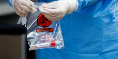 Brasil é o 2º país com maior número de curados do Covid-19 do mundo