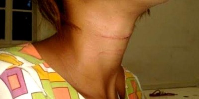 Filha salva a mãe de ser assassinada e esquartejada pelo marido em residência
