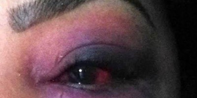 Ex-marido invade residência, espanca mulher e toma criança do colo dela
