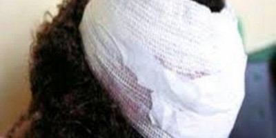 Mulher é agredida a pauladas e tem botijão de gás roubado por ex-marido
