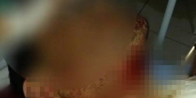 Homem é atacada pelo namorado com uma facada no pescoço