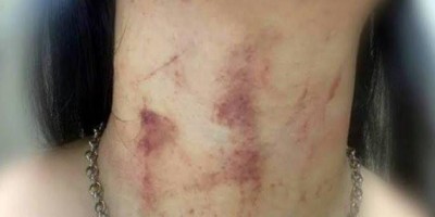 Após comemorar o Dia dos Namorados, marido tenta matar mulher enforcada