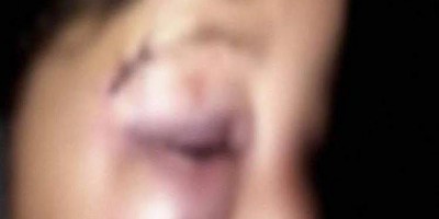 Mulher é agredida com cabeçadas pelo marido no Dia dos Namorados