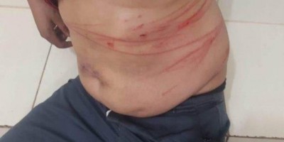 Ex-marido e mulher são presos após se agredirem por causa dos filhos