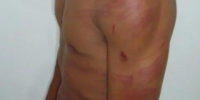 Mulher arromba porta de residência e ataca ex-marido a capacetadas