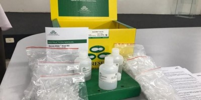 Lacen recebe doações de kits 'padrão ouro' para detectar o novo coronavírus em...
