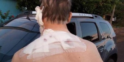 Idoso é atacado com golpes de pá na cabeça durante discussão com o vizinho