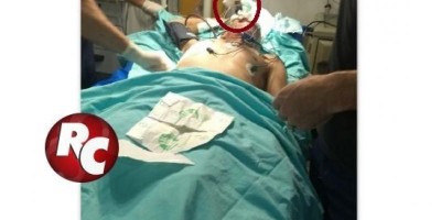 Após briga com desafeto, homem fica com faca cravada no olho, em São Francisco