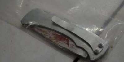 Adolescente de 15 anos é atacado com canivete ao ser confundido com integrante de...