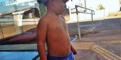 Criança de 03 anos prende panela de pressão na cabeça e é socorrido por Bombeiros em...