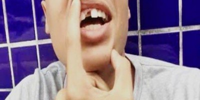 Briga entre irmãos por causa de internet acaba em agressão e dente quebrado