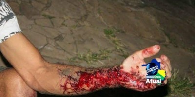 Durante discussão, homem é esfaqueado no braço em Ji-Paraná