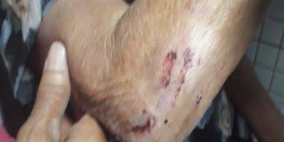 Ex-policial militar foge após agredir e arrastar mãe idosa pelos cabelos