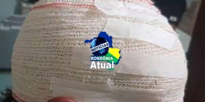 Em Ji-Paraná, vítima de roubo é espancada a pauladas na cabeça até desmaiar