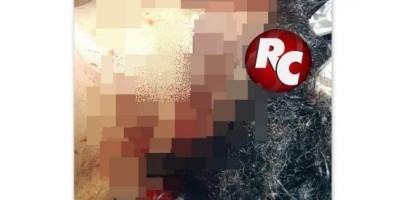 Mulher é atropelada e agredida com machadinha em São Miguel