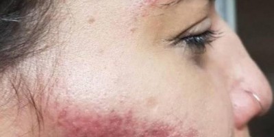 Marido foge após agredir esposa a pauladas durante discussão