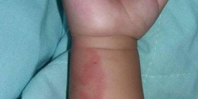 Mãe embriagada é presa por agredir bebê de três meses em Candeias do Jamari