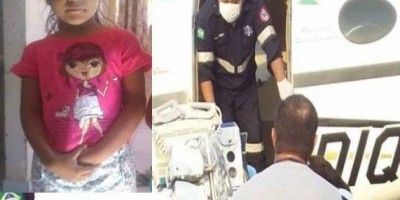 Menina de 6 anos é atingida por fogo durante churrasco em família