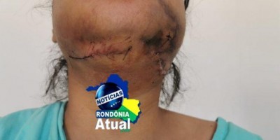 Suspeito de quebrar maxilar de mulher e provocar perda de bebê em gestação é preso,...