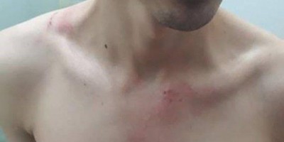 Jovem é socorrido para a UPA após ser agredido pelo vizinho do amigo