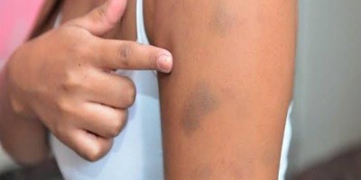 Namorada nega sexo em hotel e é espancada por homem