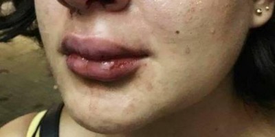 Mulher que viajou de MG à Ji-Paraná, acaba agredida por pretendente que conheceu na...