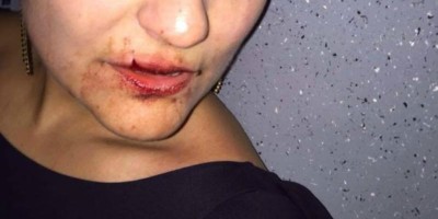Mulher é agredida pelo marido durante acampamento em Ji-Paraná