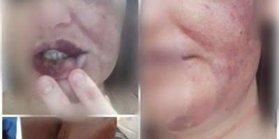 Mulher corre seminua pelas ruas de Vilhena fugindo do ex que a espancou e ainda tentou...