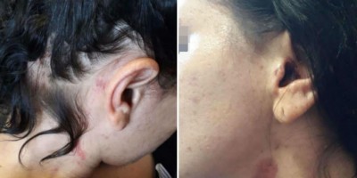 Após confusão por causa de fofoca, mulher é agredida por três sobrinhas