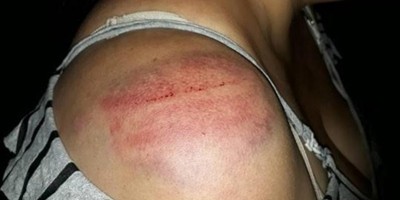 Filho é preso após surrar mãe que mandou fazer serviços domésticos