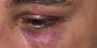 Para se defender de agressão, mulher ataca marido a facada
