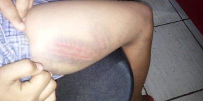 Mãe é presa após surrar a filha com fio por ter saído de casa