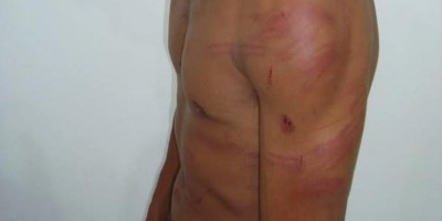 Mulher invade residência e espanca ex-marido por ciúmes