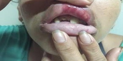 Irmã pede que irmão pare de beber e acaba agredida a socos