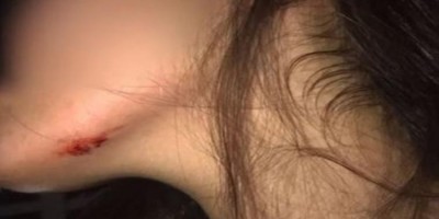 Mulher de 25 anos é espancada pelos tios com socos e chutes