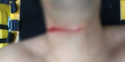 Mulher é encontrada morta com corte no pescoço em Buritis; suspeita é de feminicídio