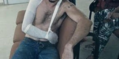 Homem é atacado com barra de ferro pela ex-mulher inconformada com separação