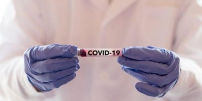 Secretário de Saúde diz que medidas mais restritivas podem ser adotadas se números de...