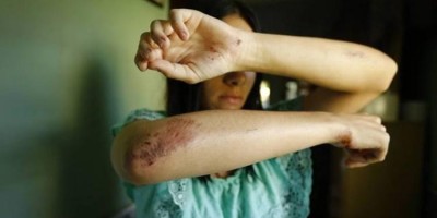 Dona de casa é hospitalizada ao ser agredida com barra de ferro pelo marido durante...