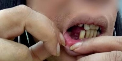 Confraternização de Natal acaba com mulher agredida pelo marido