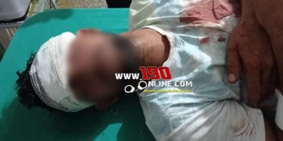 Durante bebedeira, homem é atacado com golpes de facão em Alta Floresta