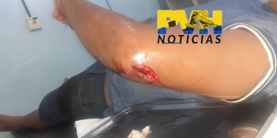 Homem é esfaqueado pelo pai de ladrão após tentar recuperar moto roubada