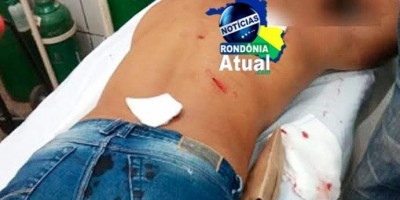 Ji-Paraná: Homem tenta reatar namoro com sua ex e acaba esfaqueado pelo atual namorado...