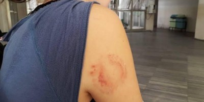 Cabo da PM é detido por agredir mulher com socos e mordidas, mas acaba solto por...