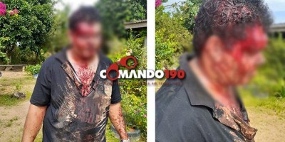 Motorista de aplicativo é brutalmente espancado por assaltantes em Ji-Paraná; suspeitos...
