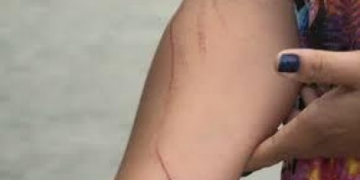 Filha é presa após agredir e tentar matar mãe a facadas