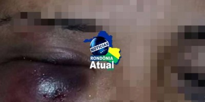 Mãe com bebê de 7 meses é espancada pelo 'namorado' em Ji-Paraná