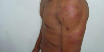 Mulher é presa após se autolesionar para acusar marido de agressão